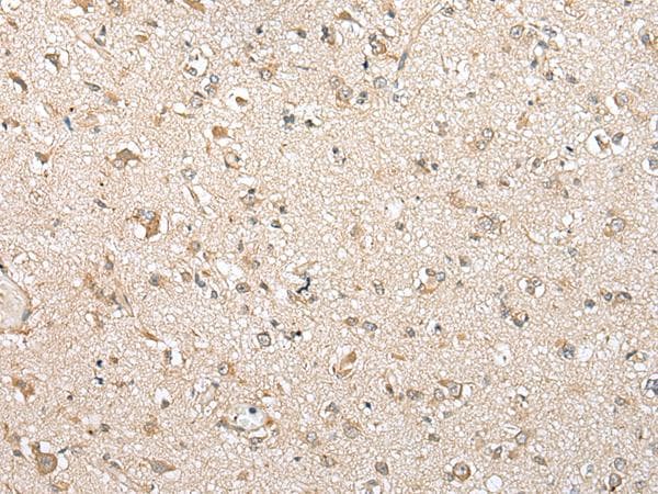NUDT10 Antibody