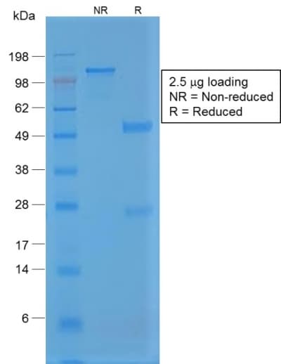 Recombinant Monoclonal Rabbit anti-Human VWF / Von Willebrand Factor Antibody (clone VWF/1859R, aa1815-1939, IHC, WB)