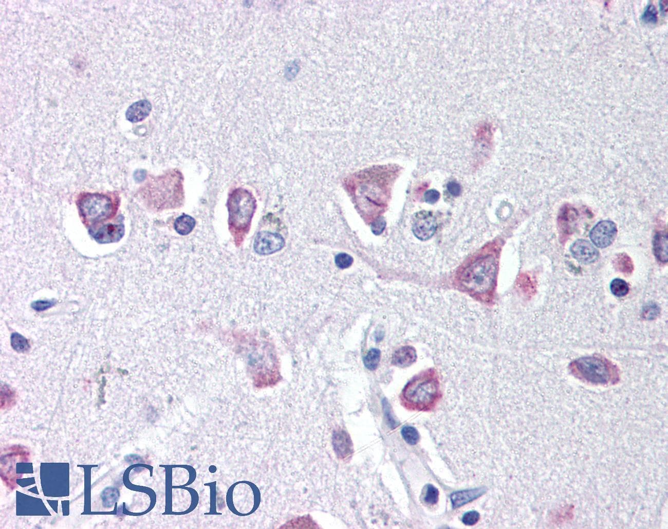 IREB2 / IRP2 Antibody (Internal, Biotin)