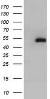 HP / Haptoglobin Antibody (clone OTI2B8)
