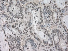 BUB1B / BubR1 Antibody (clone OTI5D9)