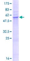 Human SLC25A51 / MCART1 Protein (Recombinant GST)