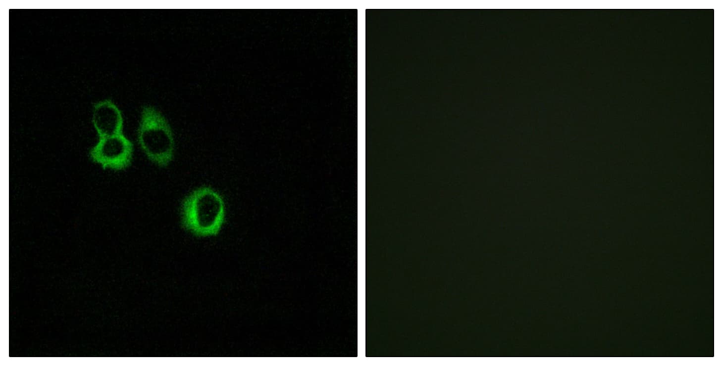 OR3A2+3 Antibody (Internal)
