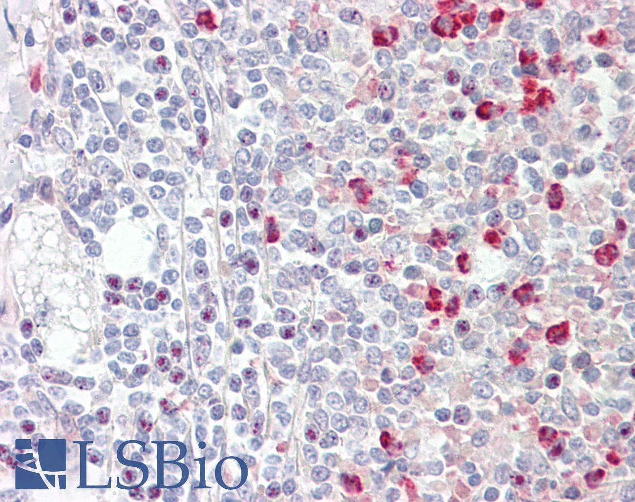 IHC-plus™ GNAQ Antibody