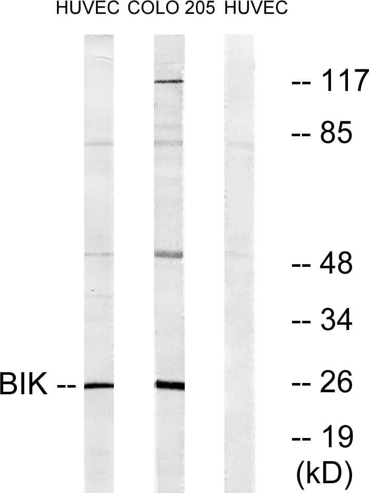 BIK Antibody (aa18-67)