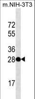 CTG-B45d / THAP11 Antibody (aa165-193)