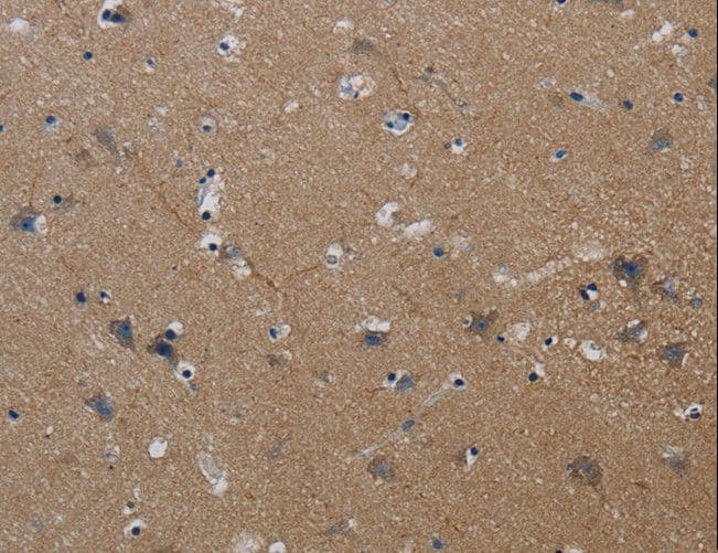 PIK3CG / PI3K Gamma Antibody