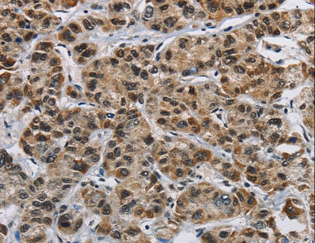 HNRNPL / hnRNP L Antibody