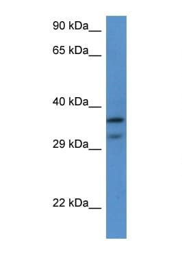 RPL7 / Ribosomal Protein L7 Antibody (C-Terminus)