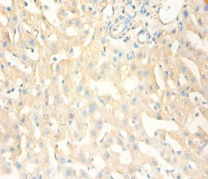 MT1X Antibody