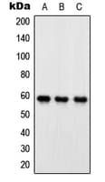 IHC-plus™ OXSR1 / OSR1 Antibody (Internal)