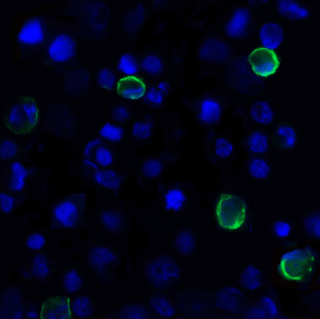 TIGIT Antibody (clone 7.00E+05)