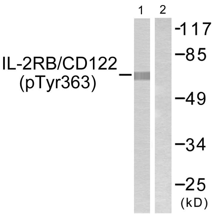 Polyclonal Rabbit anti-Human IL2RB / CD122 Antibody (phospho-Tyr364, WB)
