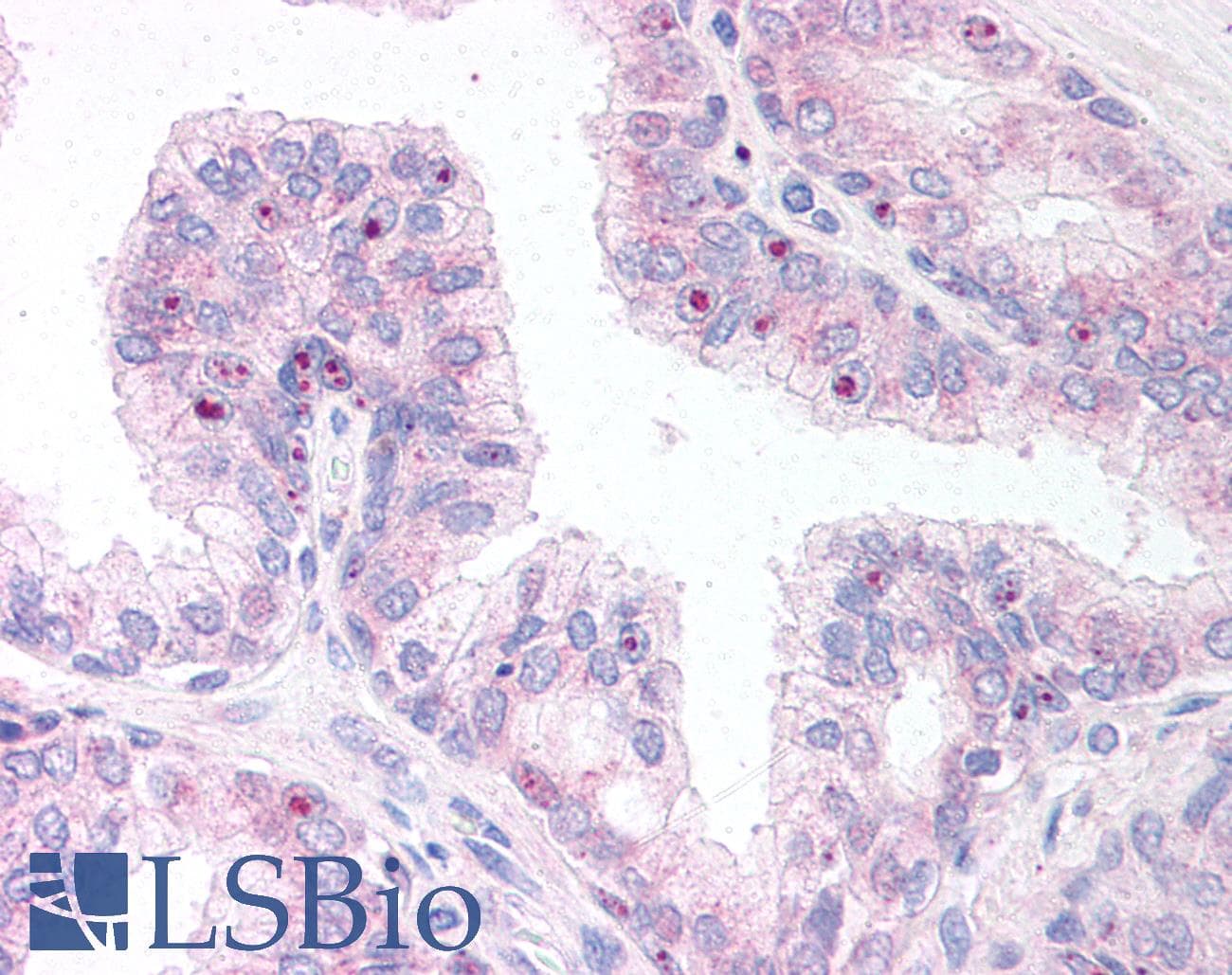 IHC-plus™ ERG Antibody (aa469-481)