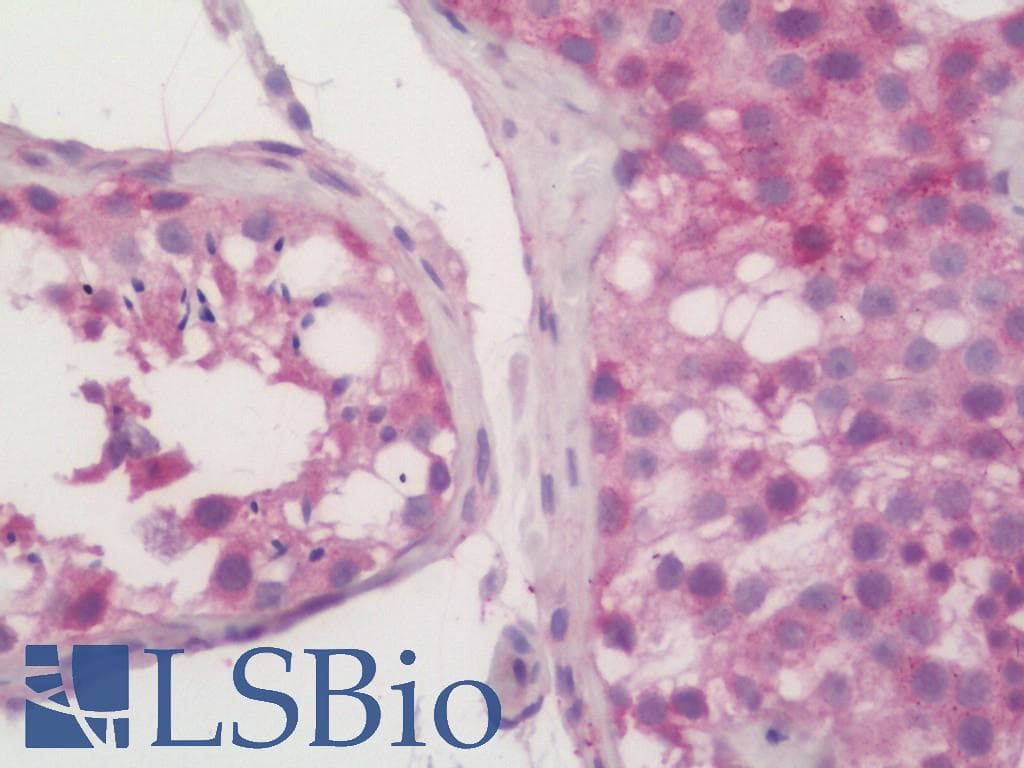 IHC-plus™ Monoclonal Mouse anti-Human MAGEA3 Antibody (clone 1H1, IHC, WB)