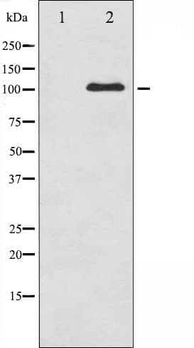 GRIN1 / NMDAR1 Antibody (phospho-Ser890)