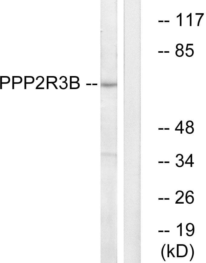 PPP2R3B Antibody