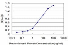 EPHB3 / EPH Receptor B3 Antibody (clone 1B3)