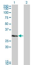 Monoclonal Mouse anti-Human KCNIP2 / KCHIP2 Antibody (clone 3E7, WB)