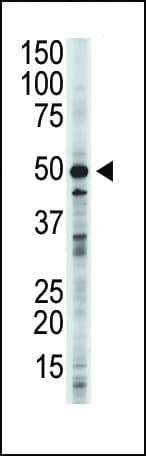 GSK3B / GSK3 Beta Antibody (aa4-34)
