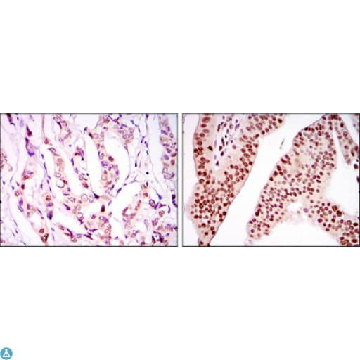 PSIP1 / LEDGF Antibody