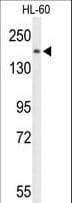 PLCB1 / Phospholipase C Beta 1 Antibody (aa1148-1176)