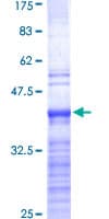 Human RPL19 / Ribosomal Protein L19 (Recombinant GST, N-terminus)