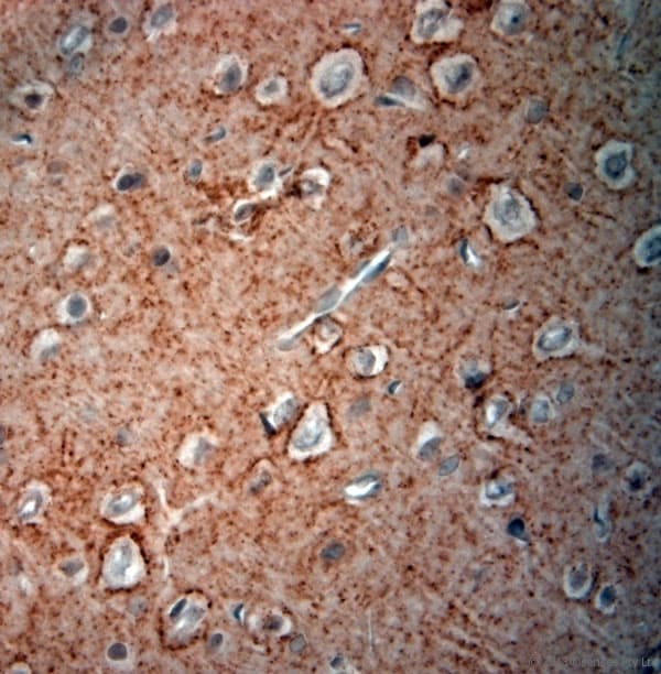 GAD 65+67 Antibody (aa530-600)
