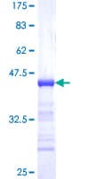 Human TIMELESS Protein (Recombinant GST, N-terminus)