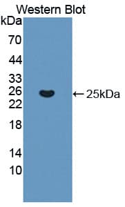 KRAS Antibody (aa1-189)