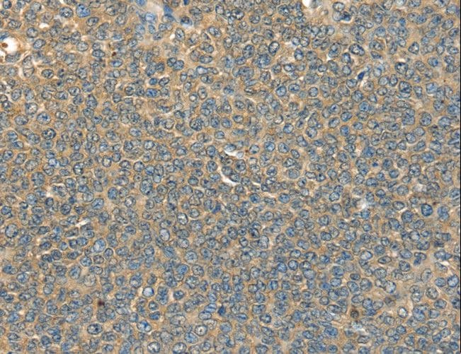 DHCR24 / Seladin-1 Antibody