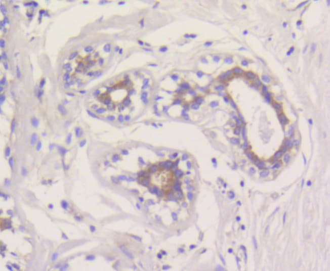 MCL1 / MCL 1 Antibody
