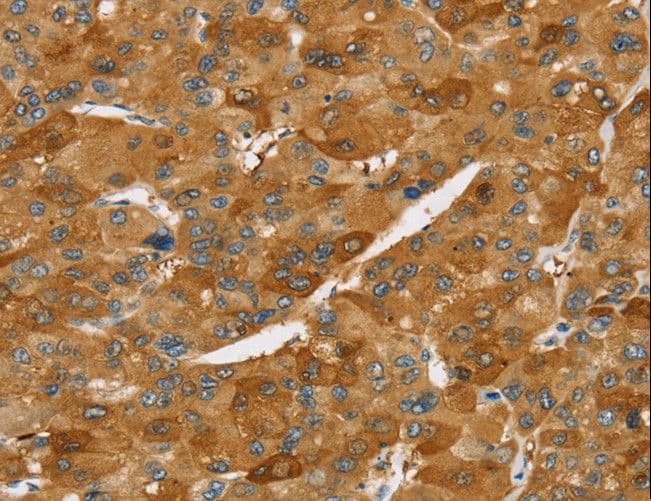 TNFSF15 / TL1A / VEGI Antibody