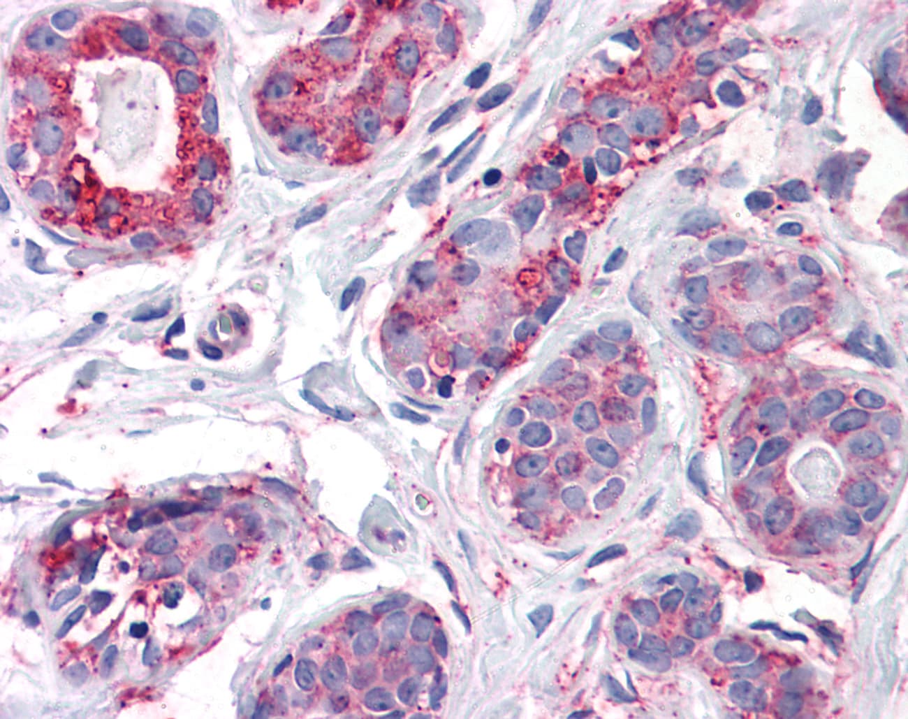 IHC-plus™ ENTPD2 Antibody (Internal)