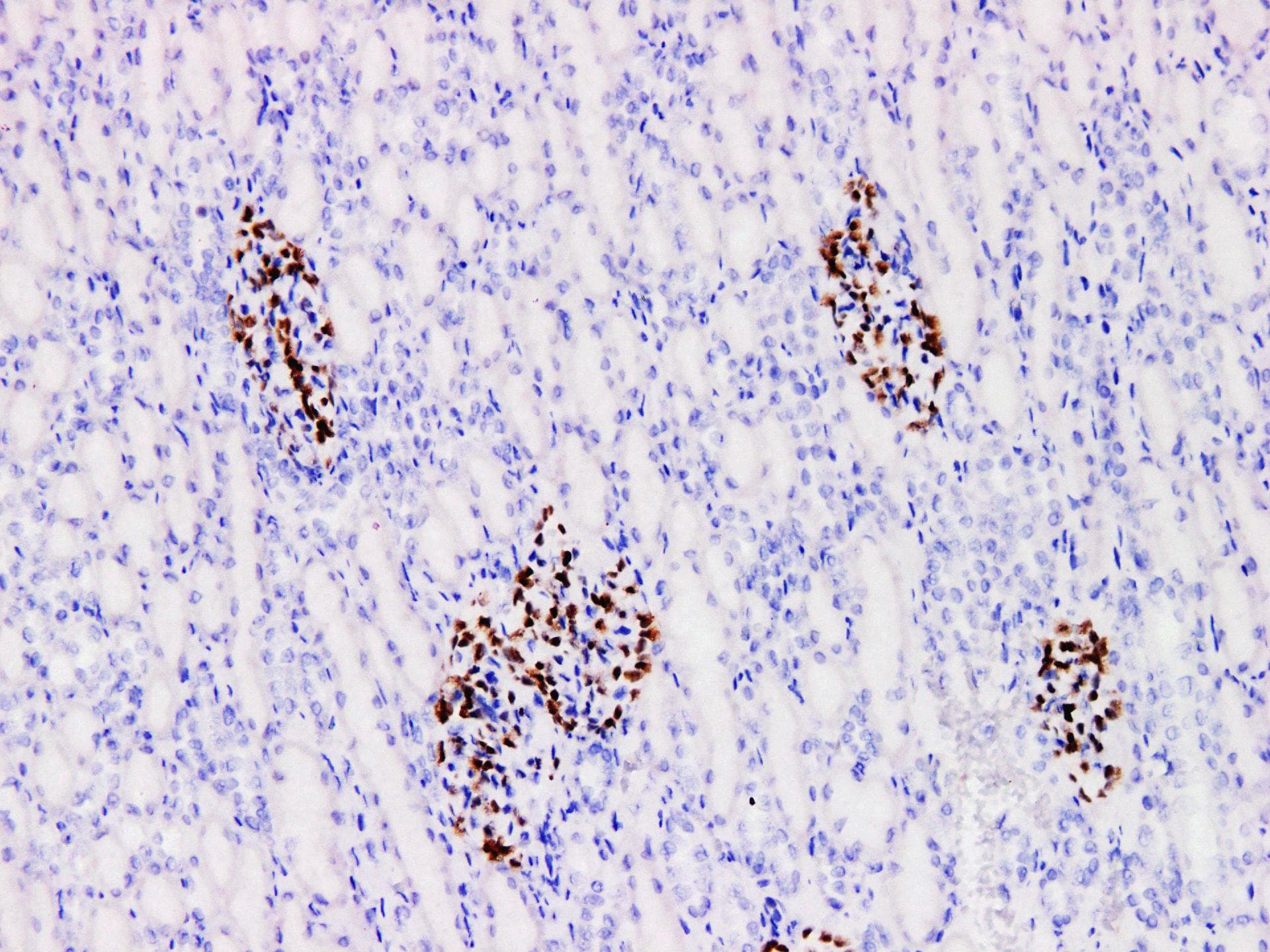 Monoclonal Mouse anti-Human WT1 / Wilms Tumor 1 Antibody (IHC)