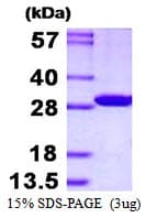 Human CMBL Protein (Recombinant His)