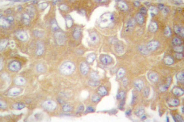 FRK Antibody (Asn103)
