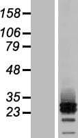 MRAP2 Protein (Over-Expression Lysate Myc-DDK (Flag))