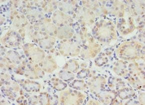 Polyclonal Rabbit anti-Human STX10 / Syntaxin 10 Antibody (IHC)