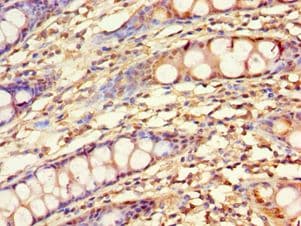 Polyclonal Rabbit anti-Human KLF4 Antibody (aa30-230, IHC, WB)