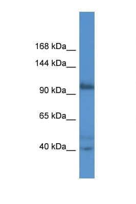 Polyclonal Rabbit anti-Human AFAP1L2 / XB130 Antibody (aa66-115, WB)