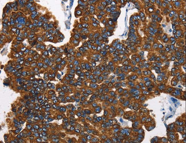 KRT8 / CK8 / Cytokeratin 8 Antibody