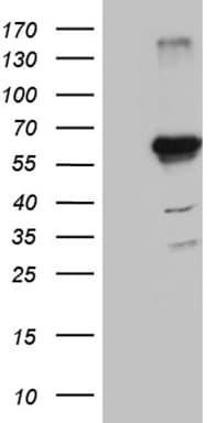 Monoclonal Mouse anti-Human KLF5 / BTEB2 Antibody (clone OTI6D2, aa1, IHC, WB)