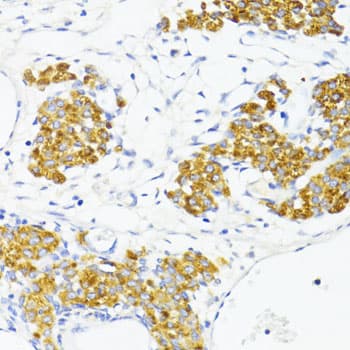 FN1 / Fibronectin Antibody