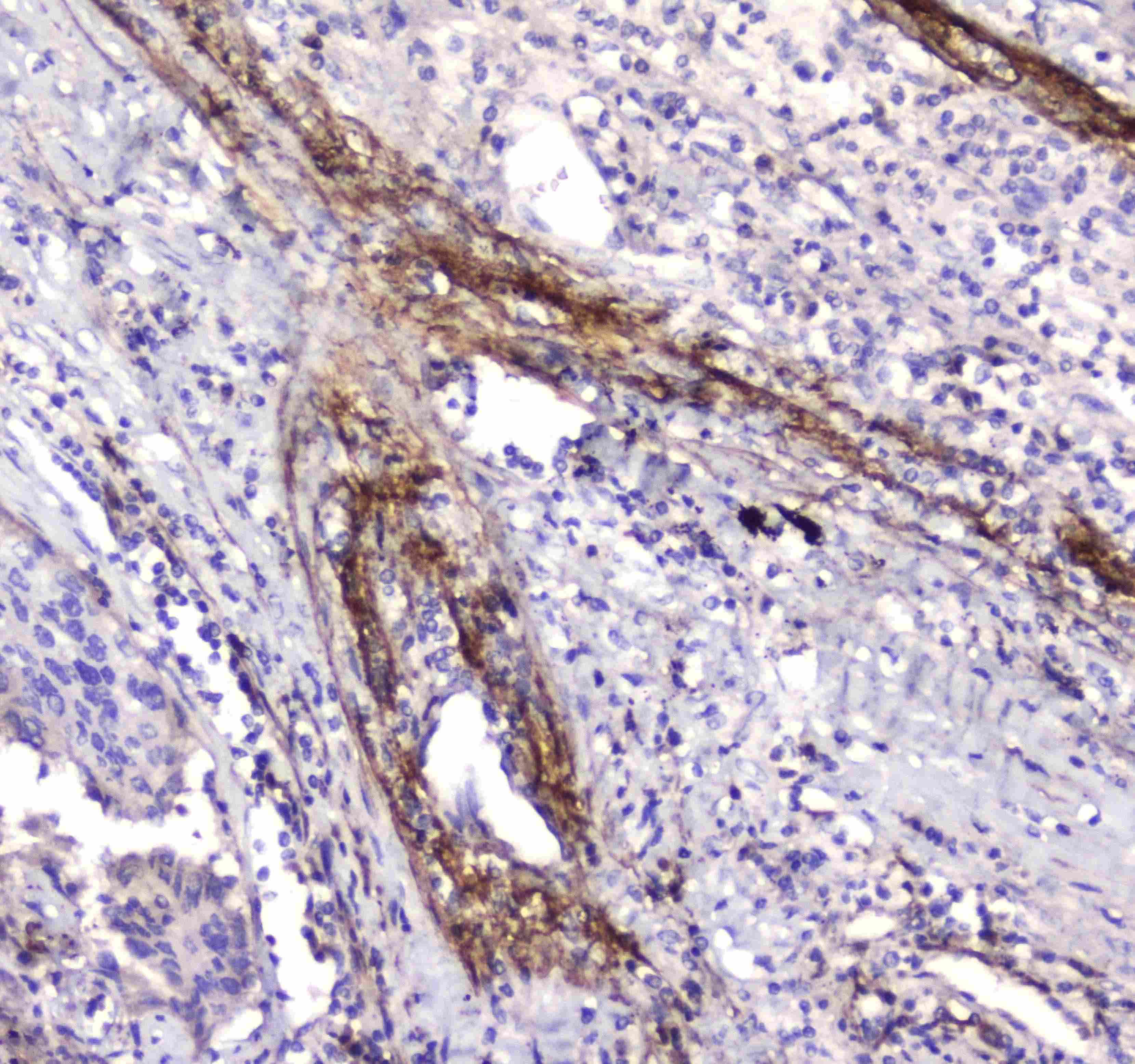 Polyclonal Rabbit anti-Human APCS / Serum Amyloid P / SAP Antibody (IHC, WB)