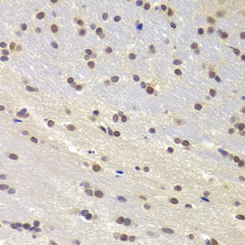 PRPF3 Antibody