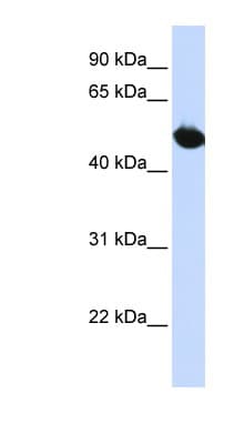 SLC2A9 / GLUT9 Antibody (aa288-337)
