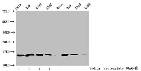 HIST1H2BN Antibody