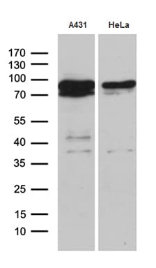 Monoclonal Mouse anti-Human EEF1D Antibody (clone OTI4B9, IHC, WB)