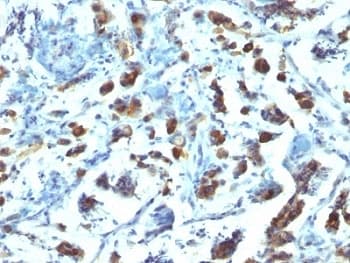 MUC3A Antibody (Tandem Repeat, clone SPM200)